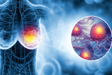 RSNA AI 挑戰(zhàn)賽模型可獨(dú)立解讀乳腺 X 光片：組合頂級(jí)算法性能接近人類水平